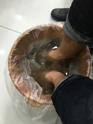-派恩宜灰指甲·甲沟炎·鸡眼康护