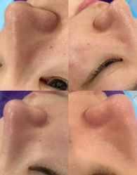 -蕾特恩专业祛痘·皮肤管理