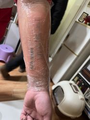 -一次性洗纹身·修复疤痕·超皮秒