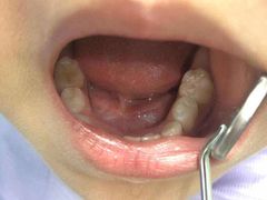 -华颜美口腔矫正·种植牙