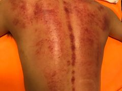 -御一坊盲人推拿(青年路店)