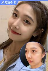 -北京米扬丽格医疗美容·联合丽格鼻整形中心