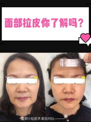 点击看大图 -长沙雅美医疗美容医院