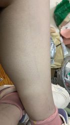 -深圳艺星医疗美容医院