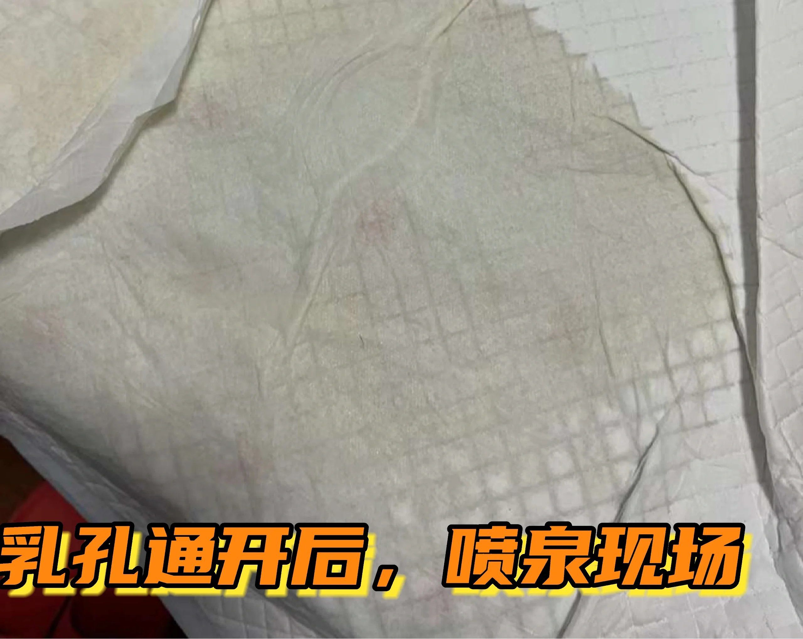 东莞催乳师上门通乳#哺乳期堵奶小白点小白泡 #产后护理 #乳腺疏通