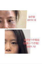 体验前-上海玫瑰医疗美容医院