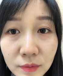 -南京健丽·去眼袋医疗美容机构