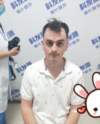 -大麦微针植发丨全国连锁