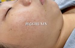 -CHUXIN初心·敏感·痘痘修护中心