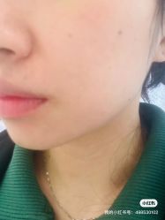 -叶美人医疗美容