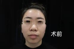 -Yestar宁波艺星整形医院