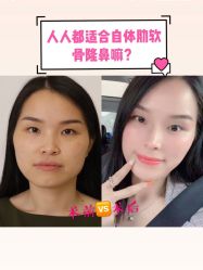 -广东韩妃整形外科医院