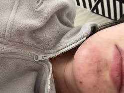 -天津健丽·去眼袋医疗美容机构