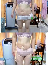 -摩瘦纤体订制减肥