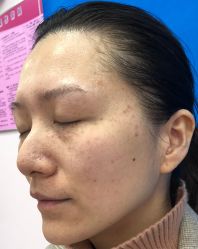 体验前-上海锦妍医疗美容门诊部