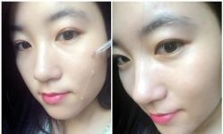 -SKINIST丽铂医疗美容