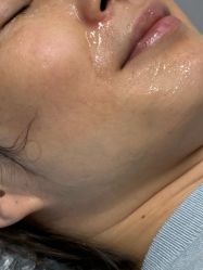 -长沙雅美医疗美容医院