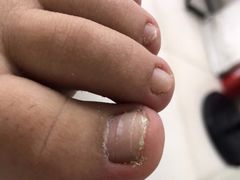 -新甲连锁灰指甲·甲沟炎·鸡眼(黑龙江路店)