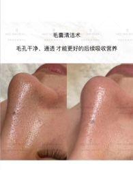 体验前-唯奈斯肌肤管理中心