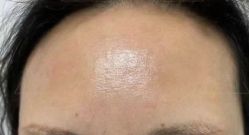 体验后-深圳美莱医疗美容医院