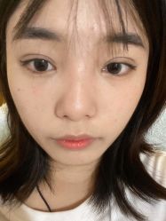 -素美医疗美容·西南眼鼻整形·修复基地