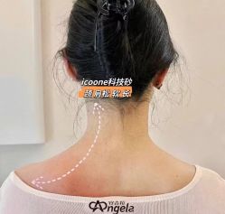 -安吉拉青春化管理中心