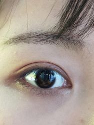 体验后-西安壹加壹医疗美容·西北抗衰旗舰店