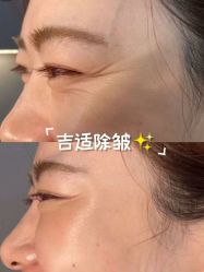 -铂特丽医美·眼鼻整形·光电美肤·注射抗衰