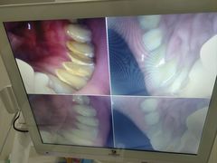 -同步齿科·数字化正畸种植口腔中心(前山店)