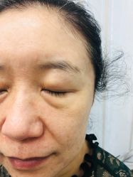 体验后-鑫元辰医疗美容整形