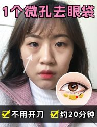 -广州健丽·去眼袋医疗美容机构