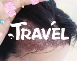 -大麦微针植发全国连锁