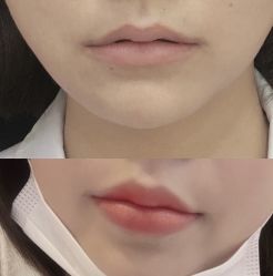 -武汉五洲整形外科医院