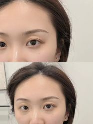 -张小野·专业半永久纹眉
