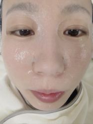 体验后-JUVA郑州欧华医疗美容医院