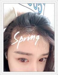 点击看大图 -大麦微针植发全国连锁