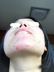-皇族养心堂·净痘·修敏·御颜