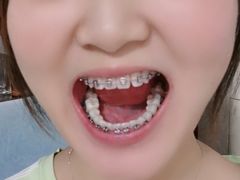 -极光口腔·矫正种植修复(锦江店)