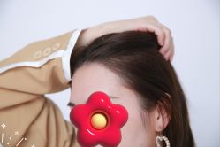 -大麦微针植发丨全国连锁