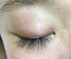 点击看大图 iphone_upload_pic-光SPA科技美肤