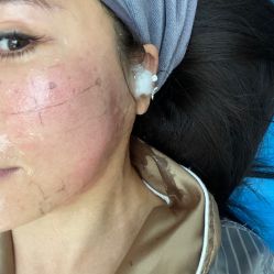 -北京润美玉之光医疗美容