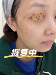 体验后-北京爱育华医院-医疗美容科