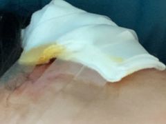 -杭州市第一人民医院(湖滨院区)