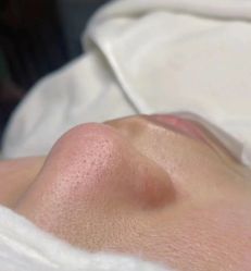 -LUNA皮相美·骨相美高级美感