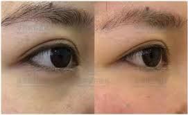 -SKINIST丽铂医疗美容