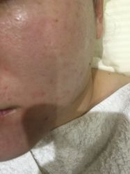 -MedSkinCare科技祛痘肌肤修护中心