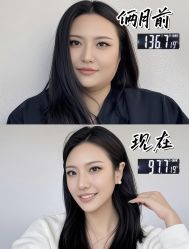 -Lily纤美·科技减脂中心