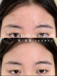 点击看大图 -MLP美丽派·问题肌疗愈中心