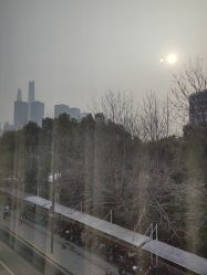 体验后-上海首尔丽格医疗美容医院