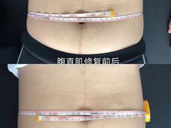 -简·无界健身工作室·运动康复·体态(石厦店)